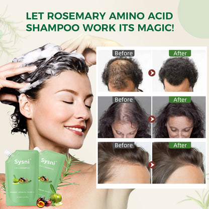 Sysni 3-in-1 Rosemary Amino Acid Shampoo