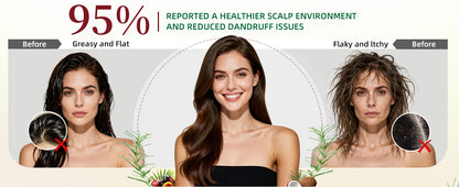 Sysni 3-in-1 Rosemary Amino Acid Shampoo